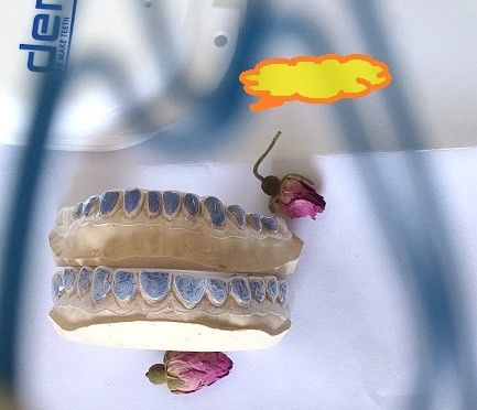 দাঁত সাদা করার জন্য কাস্টম ISO13485 ব্লিচিং ট্রে