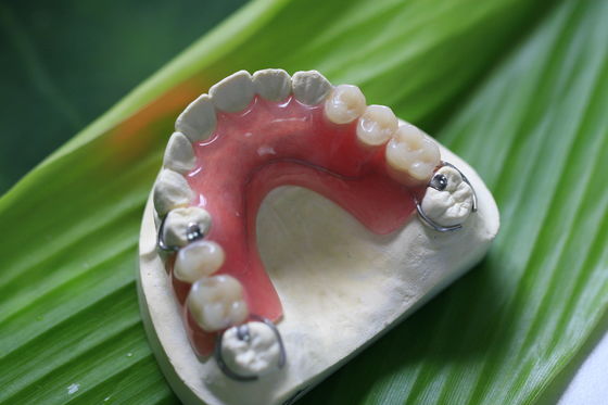 পূর্ববর্তী দাঁতে আংশিক নমনীয় অদৃশ্য দাঁত